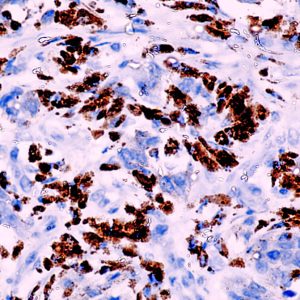 Anti-S100B, Clone S100B/1012