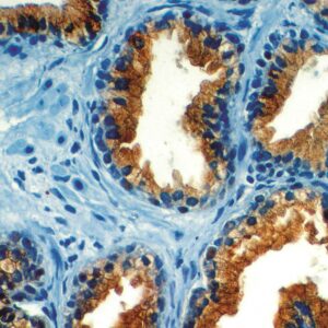 Anti-Prostate Specific Acid Phosphatase (PSAP)