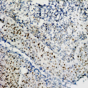 Anti-Papillomavirus Type 16 (HPV-16)