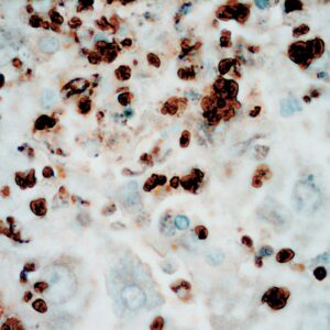 Anti-Toxoplasma gondii