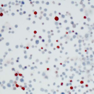 Anti-Epstein-Barr Virus (EBV) Early Antigen