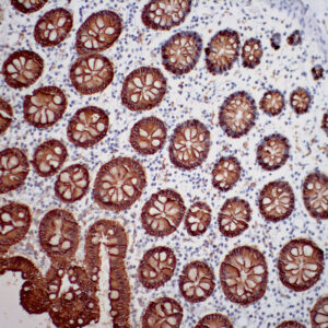 New & Improved Super Sensitive<sup>TM</sup> Polymer HRP Kit <strong>i6000</strong>