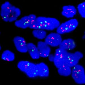 eFISH CEN 17/HER2 Dual Color Probe