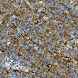 Anti-ALK/CD246, Clone ALK/1031