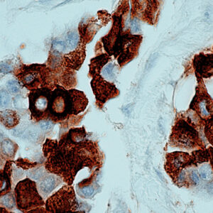 Anti-Tumor-Associated Glycoprotein (TAG-90 BCA)