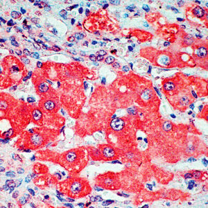 Anti-Alpha-Fetoprotein (AFP)