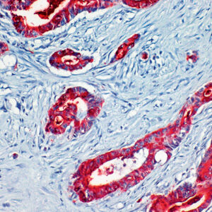 Anti-Carcinoembryonic Antigen (CEA)