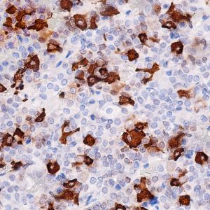 Anti-Thyroid Stimulating Hormone (TSH)