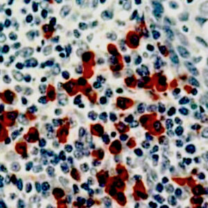 Anti-Kappa Light Chain