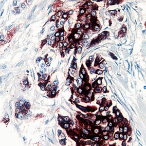 Anti-Tumor-Associated Glycoprotein (TAG-72)