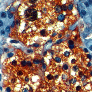 Anti-Neuron Specific Enolase (NSE)