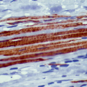 Anti-Desmin