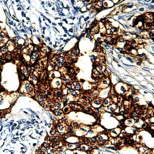 Anti-Cytokeratin, Low MW