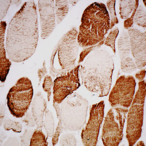 Anti-Actin; Muscle-Specific
