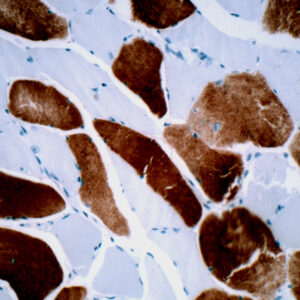 Anti-Myosin, Skeletal Muscle