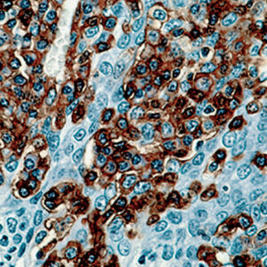 Anti-CD45 (Leukocyte common Antigen, LCA)