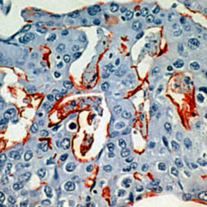 Anti-Breast Cancer Antigen (BCA) 225