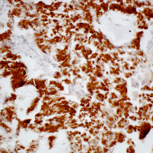 Anti-Cytokeratin 8