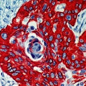 Anti-Cytokeratin 14