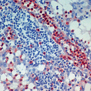 Anti-Myeloid Specific Antigen BM-1