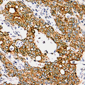 Anti-Cytokeratin, Pan