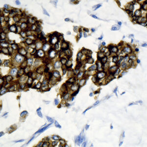 Anti-Epithelial Membrane Antigen (EMA)