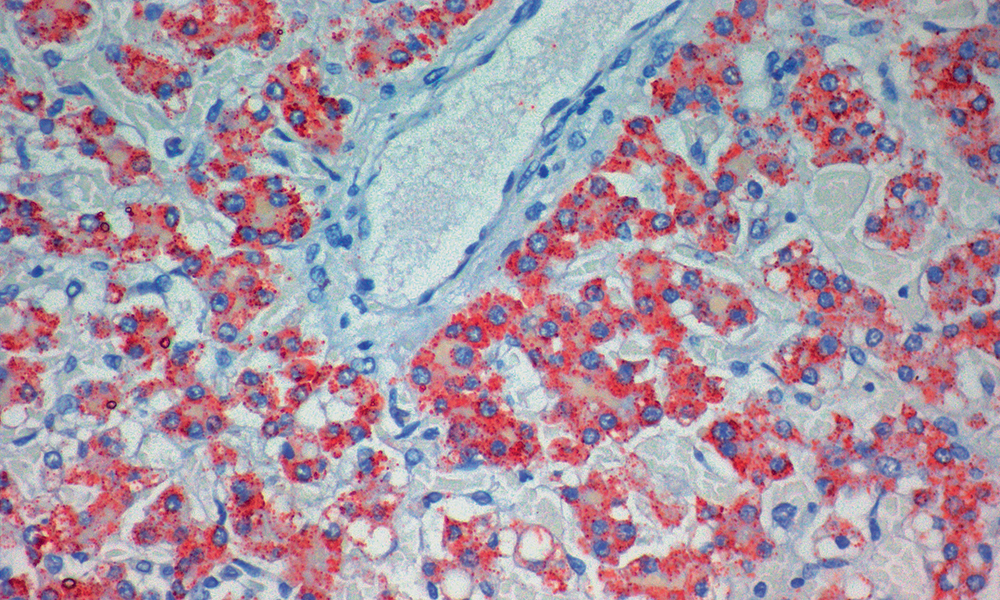 Anti-Mitochondrial Antigen