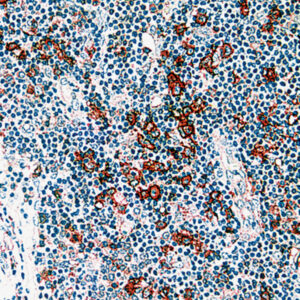 Anti-B Lymphocyte Antigen 36, BLA-36