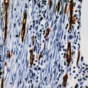 Anti-CD34 (Endothelial Cell)