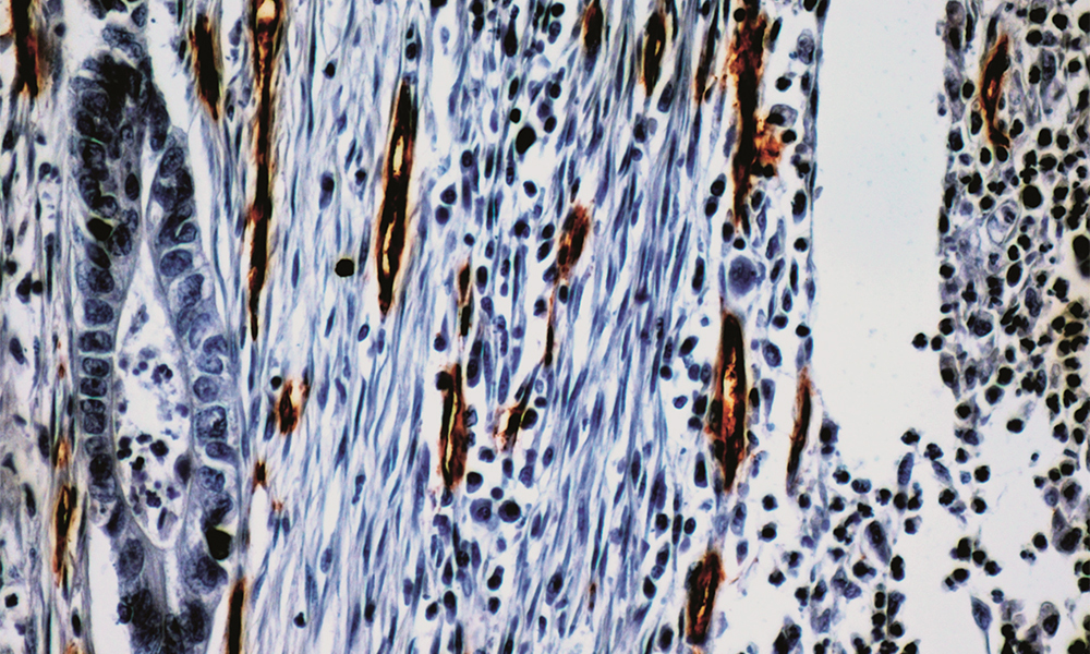 Anti-CD34 (Endothelial Cell)