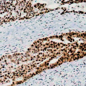 Anti-Proliferating Cell Nuclear Antigen (PCNA)