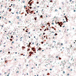 Anti-CD71 (transferrin Receptor)