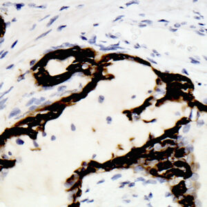 Anti-Cytokeratin, High MW