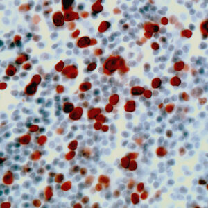 Anti-Ki-67 antigen, Proliferating Cell