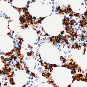Anti-CD15 (Blood group antigen Lewis X)