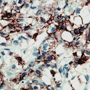 Anti-CD44 (Phagocytic Glycoprotein-1, HCAM)