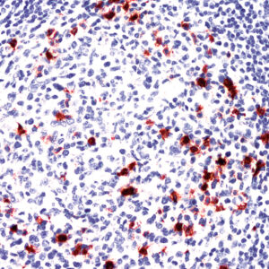 Anti-CD57 (Natural Killer Cell)