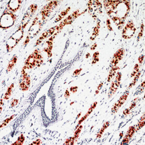 Anti-c-erbB-3 (HER-3)