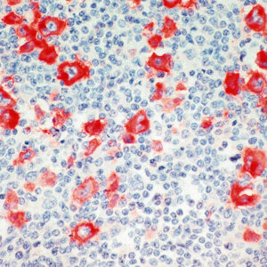 Anti-CD30 (Ki-1 Antigen)