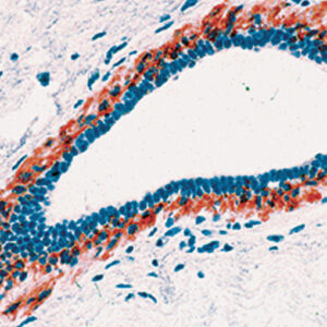 Anti-Myosin Heavy Chain, Smooth Muscle
