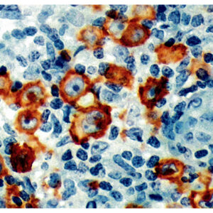 Anti-CD30 (Ki-1 Antigen)