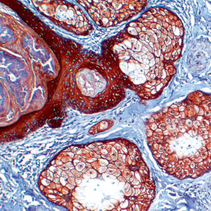 Anti-Cytokeratin, Pan