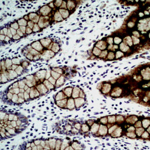 Anti-Carcinoembryonic Antigen (CEA)