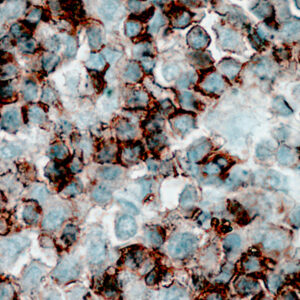 Anti-CD45 Cocktail (Leukocyte Antigen, LCA)