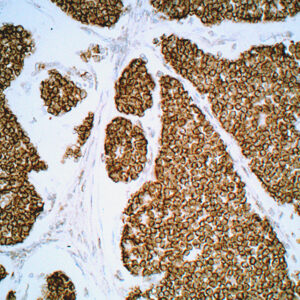 Anti-Cytokeratin cocktail, broad spectrum