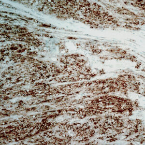 Anti-Platelet-Derived Growth Factor (PDGF)