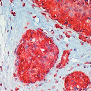 Anti-Transforming Growth Factor (TGF) Alpha