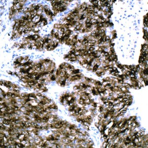Anti-Renal Cell Carcinoma (RCC)