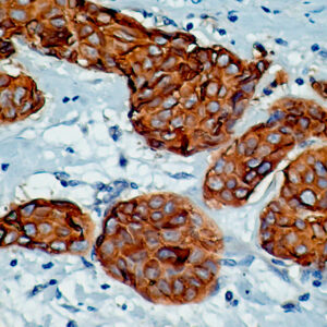 Anti-Cytokeratin 7 & 8