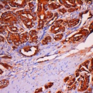 Anti-PSA (Prostate Specific Antigen), Clone IHC654